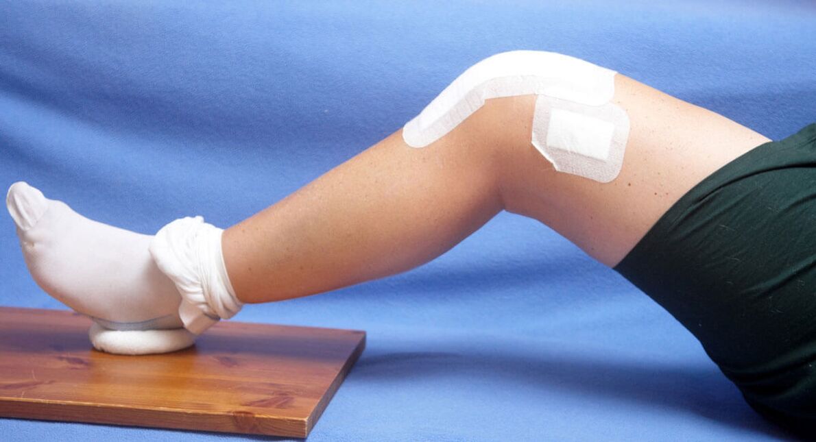 Injury to the knee as a cause of arthrosis