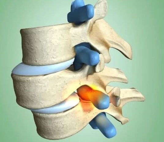 The volatile position of the spine
