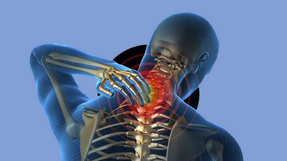Osteochondrosis of the cervical region