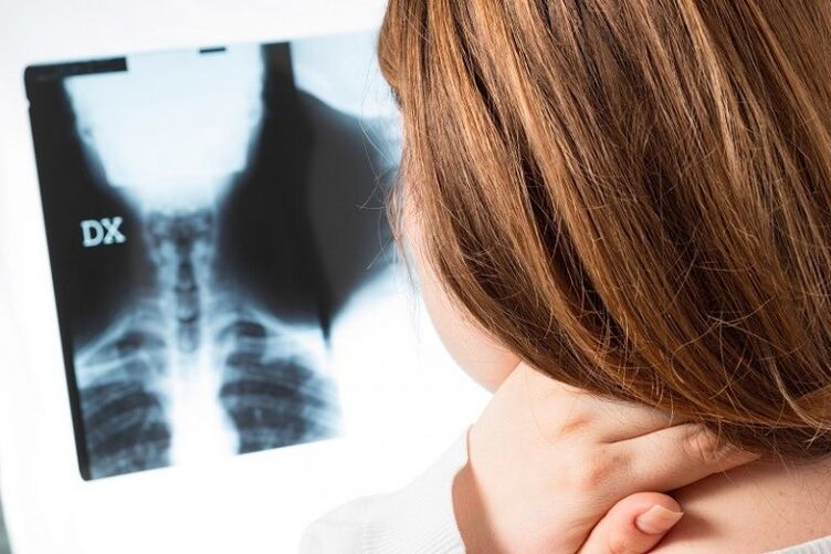 X -ray of the cervical region
