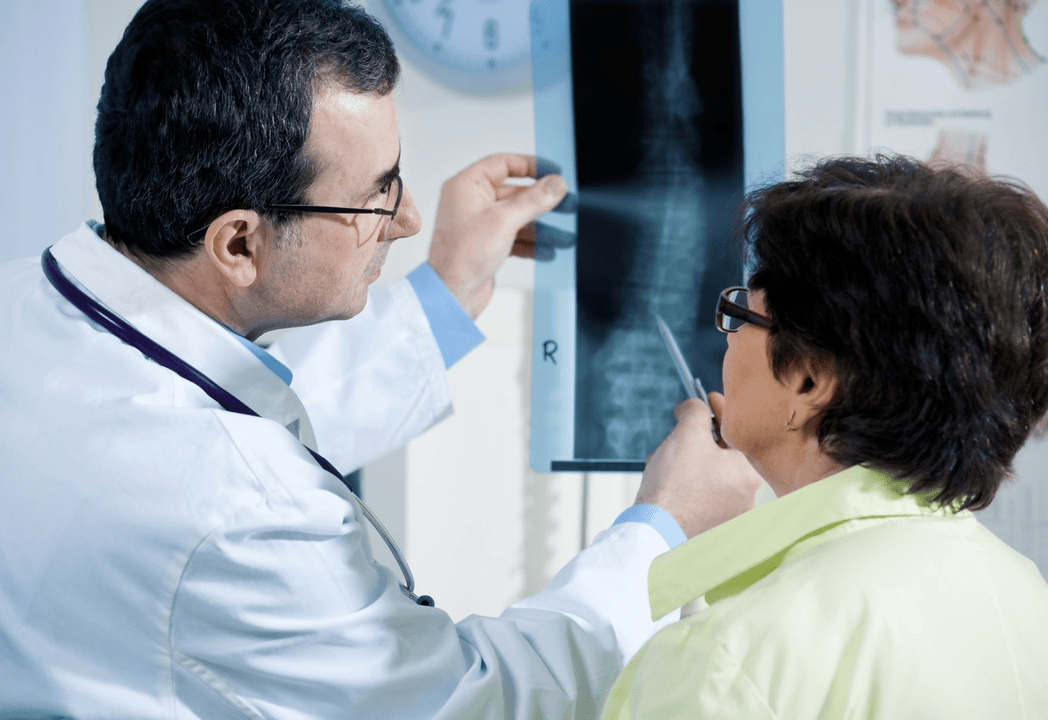 A neurologist makes a diagnosis of osteochondrosis using an X-ray of the spine
